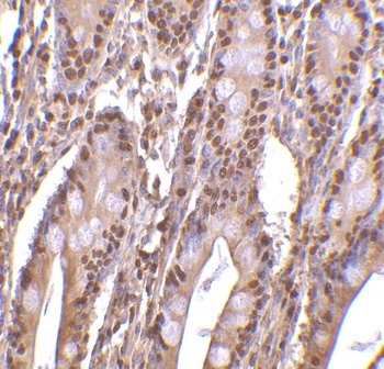 ANP32E Antibody