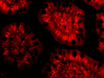 PHAP III Antibody