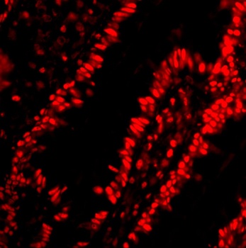 PHAP Antibody