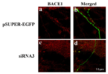 BACE1 Antibody
