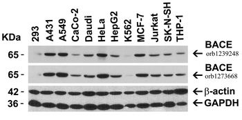 BACE1 Antibody