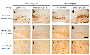 BACE1 Antibody
