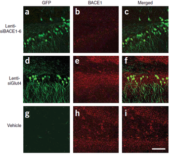 BACE1 Antibody
