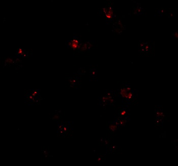 PSENEN Antibody