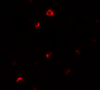 Pellino 1 Antibody