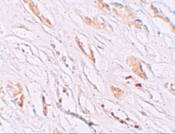 PEAR1 Antibody