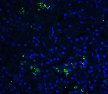 BAFF Antibody