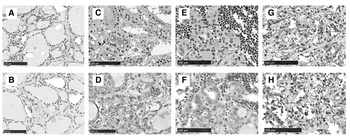 BAFF Antibody