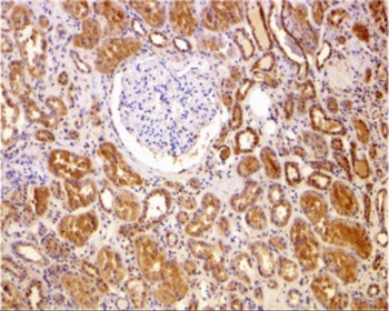 Bcl-2 Antibody