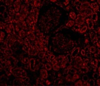 Bcl-2 Antibody