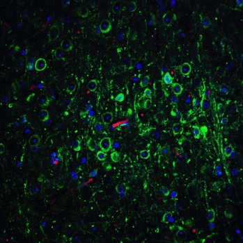 Bcl-2 Antibody