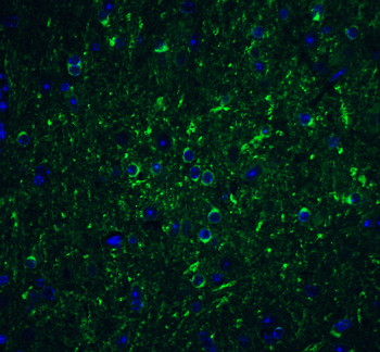 Beclin-1 Antibody