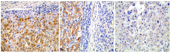 Beclin-1 Antibody