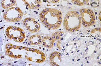 Beclin-1 Antibody