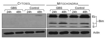 BCL2L11 Antibody