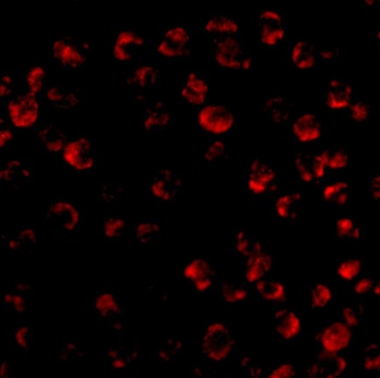 BCL2L11 Antibody