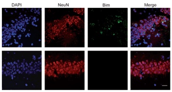 BCL2L11 Antibody