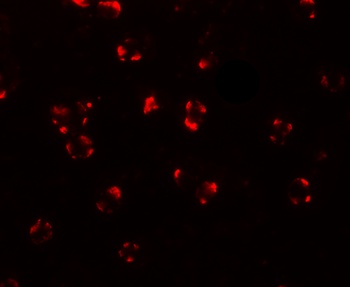 BCL2L11 Antibody