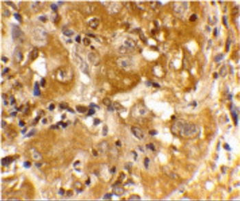 BCL2L11 Antibody