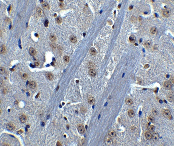 BTK Antibody