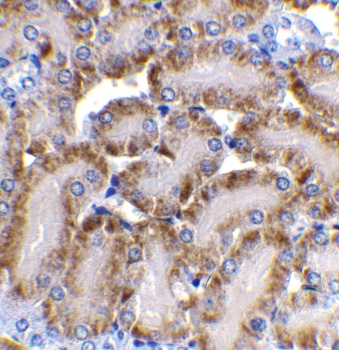 CAD Antibody