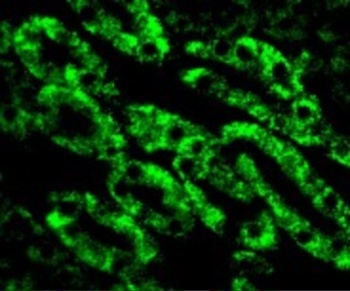 CAD Antibody