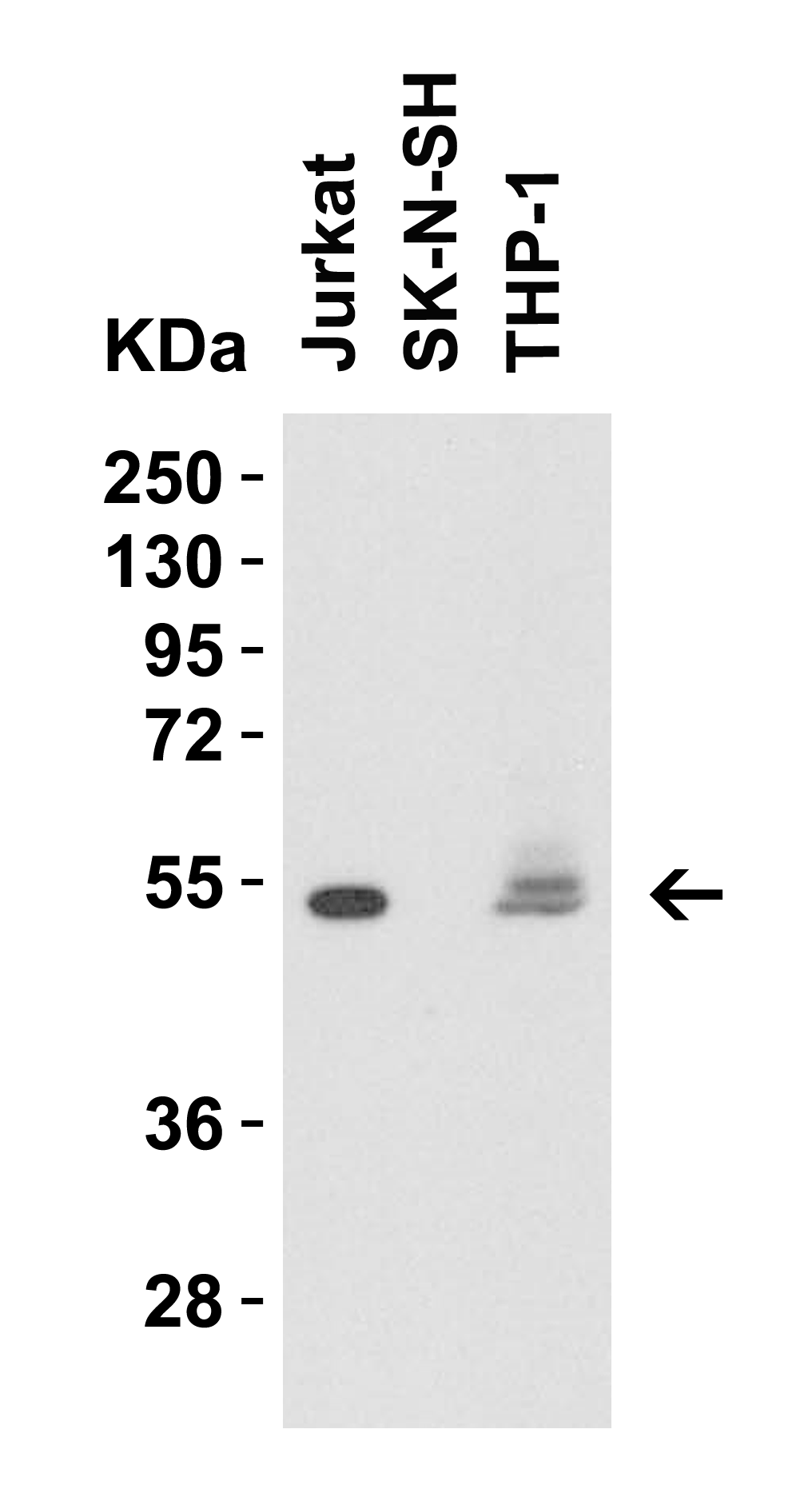 CD4 Antibody