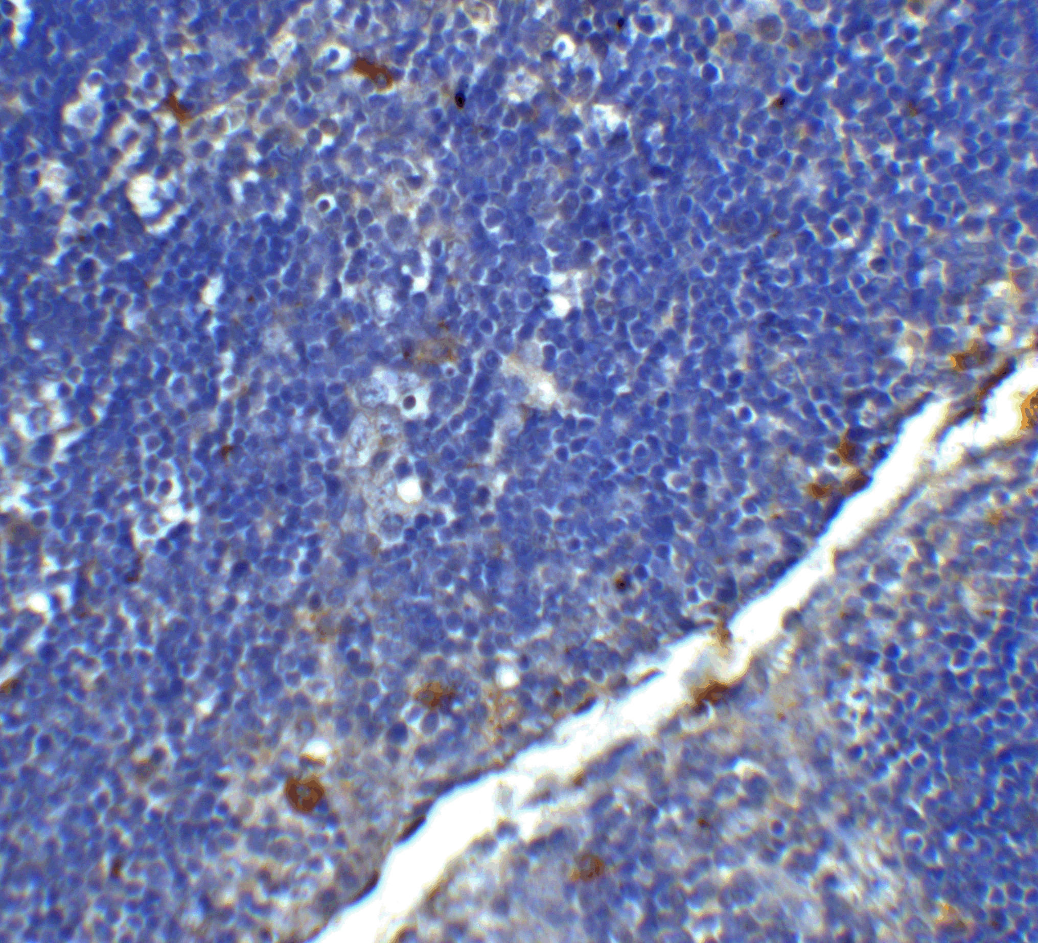 CD4 Antibody