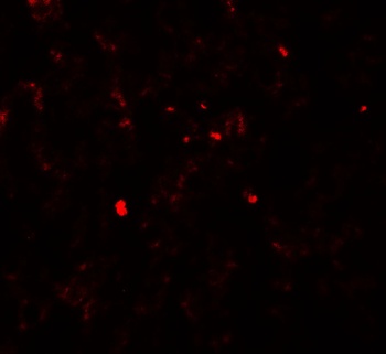 PDGFB Antibody