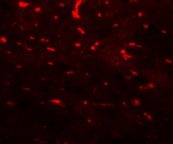 PDCL3 Antibody