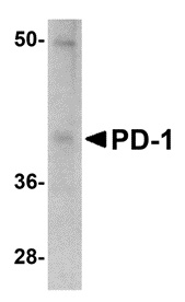 PDCD1 Antibody