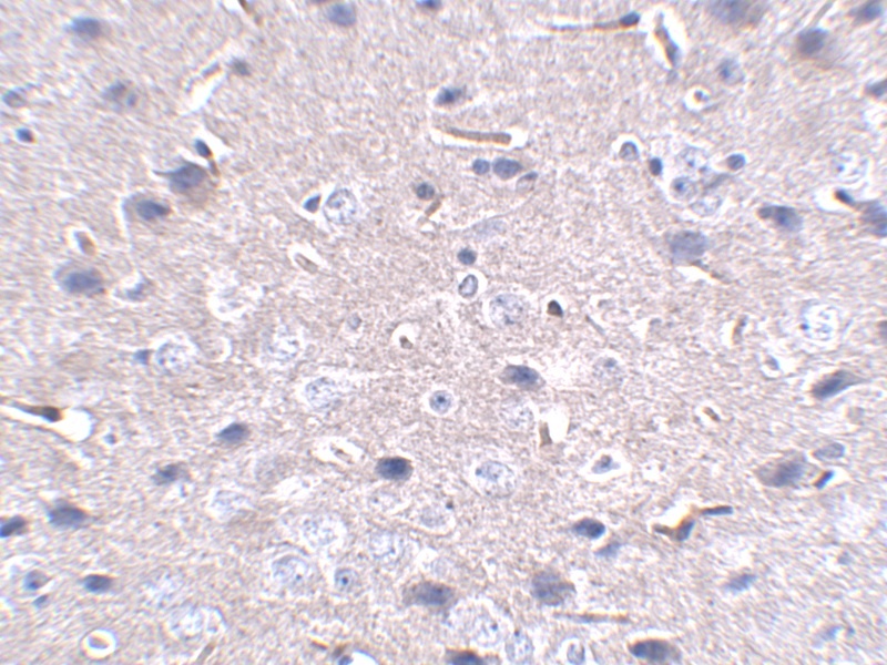 PDCD1 Antibody