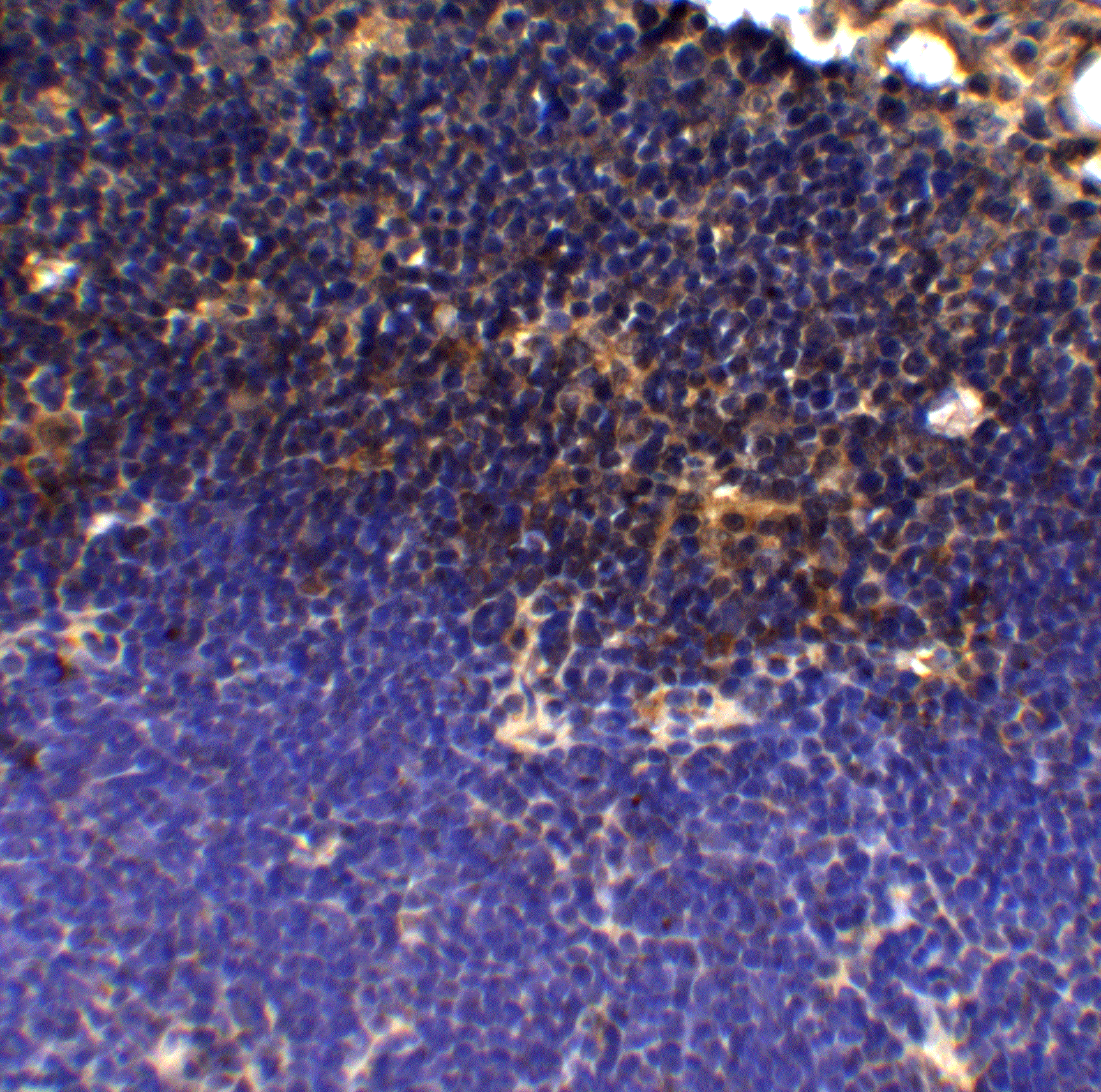 PDCD1 Antibody