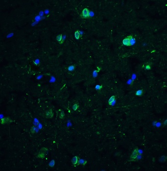 CD81 Antibody