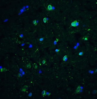 CD81 Antibody