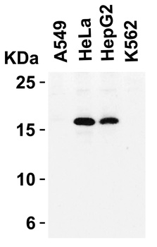 CDKN2A Antibody