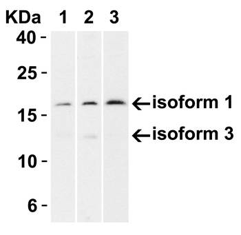 CDKN2A Antibody