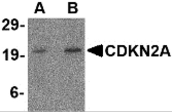 CDKN2A Antibody