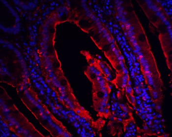 CDKN2A Antibody