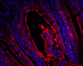 CDKN2A Antibody