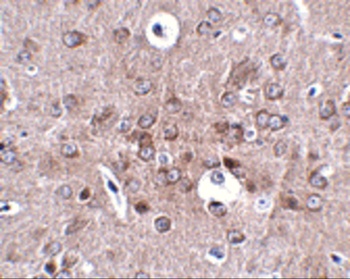 PCDH18 Antibody