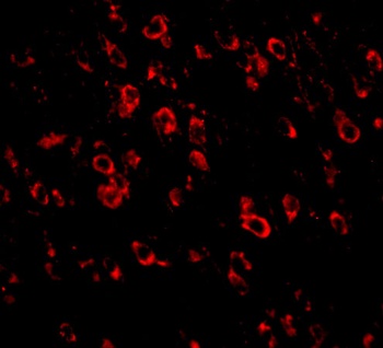 PCDH18 Antibody