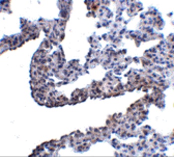 PCDH12 Antibody