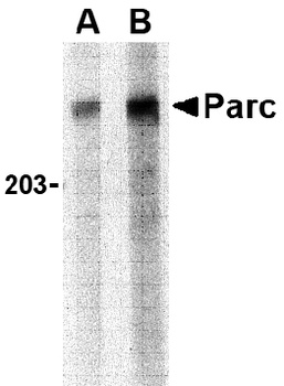 CUL9 Antibody