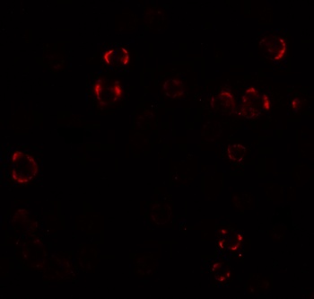 PALM3 Antibody