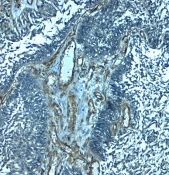 PALMD Antibody