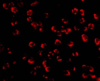 PAK5 Antibody