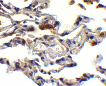 BIRC2 Antibody