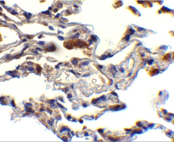 cIAP Antibody