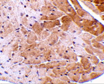 CIDEA Antibody